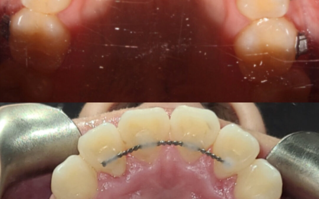 Orthodontics: More Than Just a Pretty Smile